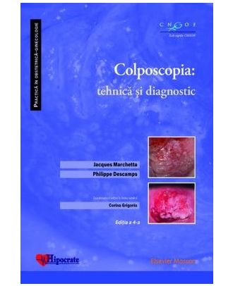 Colposcopiaa. Tehnica si diagnostic
