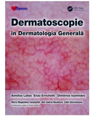 Dermatoscopie in Dermatologia Generala