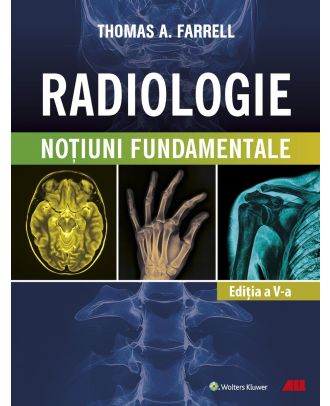 Radiologie. Noţiuni fundamentale